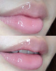 Lips Bleaching Cream