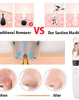 Beauty Electric Blackhead Remover