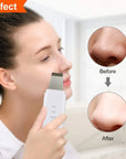 Ultrasonic Skin Scrubber