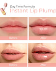 Derol Lip Plumper Kit