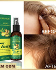 Ginger Hair Growth Serum Sprayer Hair Regrowth