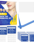 Revolutionary Automatic Skin Tag Removal Kit