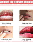 Treatment Remove Dark Smoke Lips