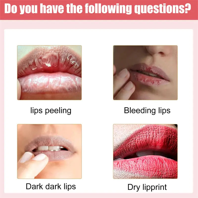 Treatment Remove Dark Smoke Lips