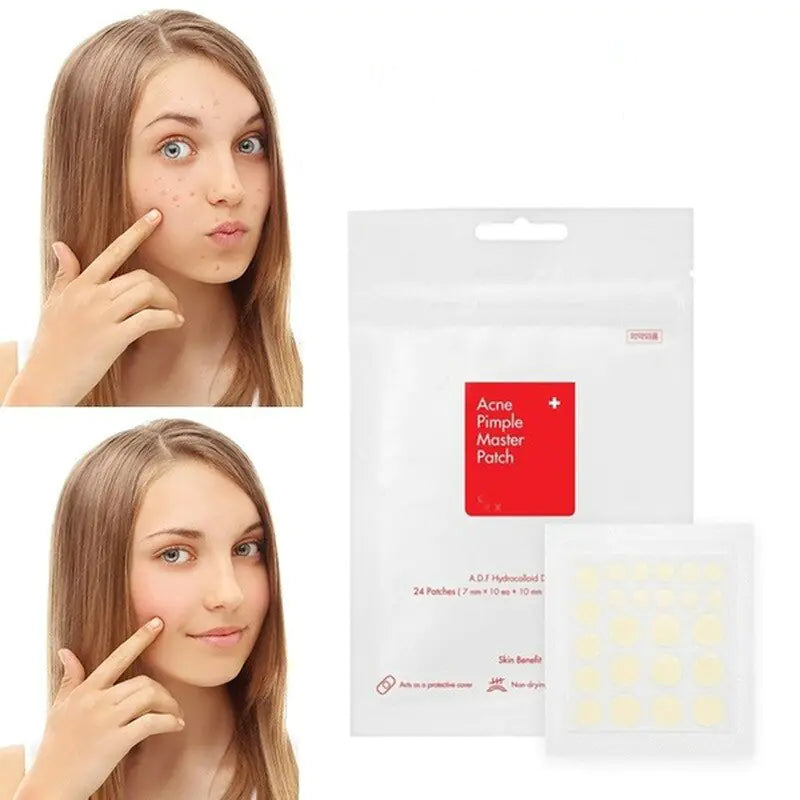 Face Acne Pimple Spot Scar Care Treatment Stickers