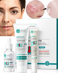 Anti Acne Removal Moisturizing Face Skin Care Kit