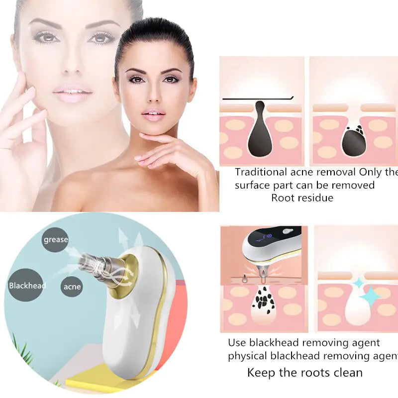 Vacuum Suction Clean Skin Care