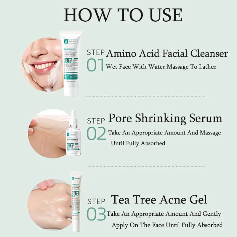 Anti Acne Removal Moisturizing Face Skin Care Kit